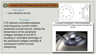 Indications:
• Low refractive errors
Principle:
CTK delivers controlled-released
radio-frequency current (within
peripheral corneal stroma, raising the
temperature of the peripheral
collagen lamellae to the 65°C
resulting in controlled shrinkage of
the peripheral collagen lamellae &
subsequent central corneal
steepening.
 