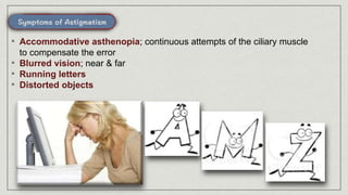 • Accommodative asthenopia; continuous attempts of the ciliary muscle
to compensate the error
• Blurred vision; near & far
• Running letters
• Distorted objects
 