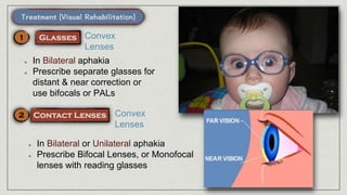 Convex
Lenses
In Bilateral aphakia
Prescribe separate glasses for
distant & near correction or
use bifocals or PALs
Convex
Lenses
In Bilateral or Unilateral aphakia
Prescribe Bifocal Lenses, or Monofocal
lenses with reading glasses
 