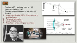 • Reading ADD in aphakic eyes is + 3D
(Accommodation is lost)
• Disadvantages of Glasses in correction of
Aphakia:
1. Image magnification (30%); Anisometropia in
unilateral cases
2. Peripheral abberation
3. Visual field constriction
4. Thick heavy lenses with poor cosmoses
 