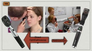Retinoscope
Direct
Ophthalmoscop
e
 