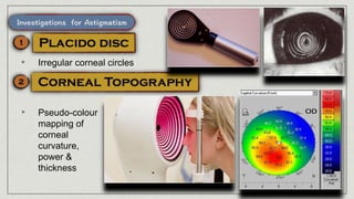 • Irregular corneal circles
• Pseudo-colour
mapping of
corneal
curvature,
power &
thickness
 