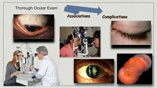 Thorough Ocular Exam
 