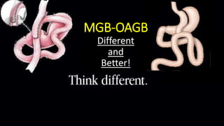 MGB-OAGB
Different
and
Better!
 