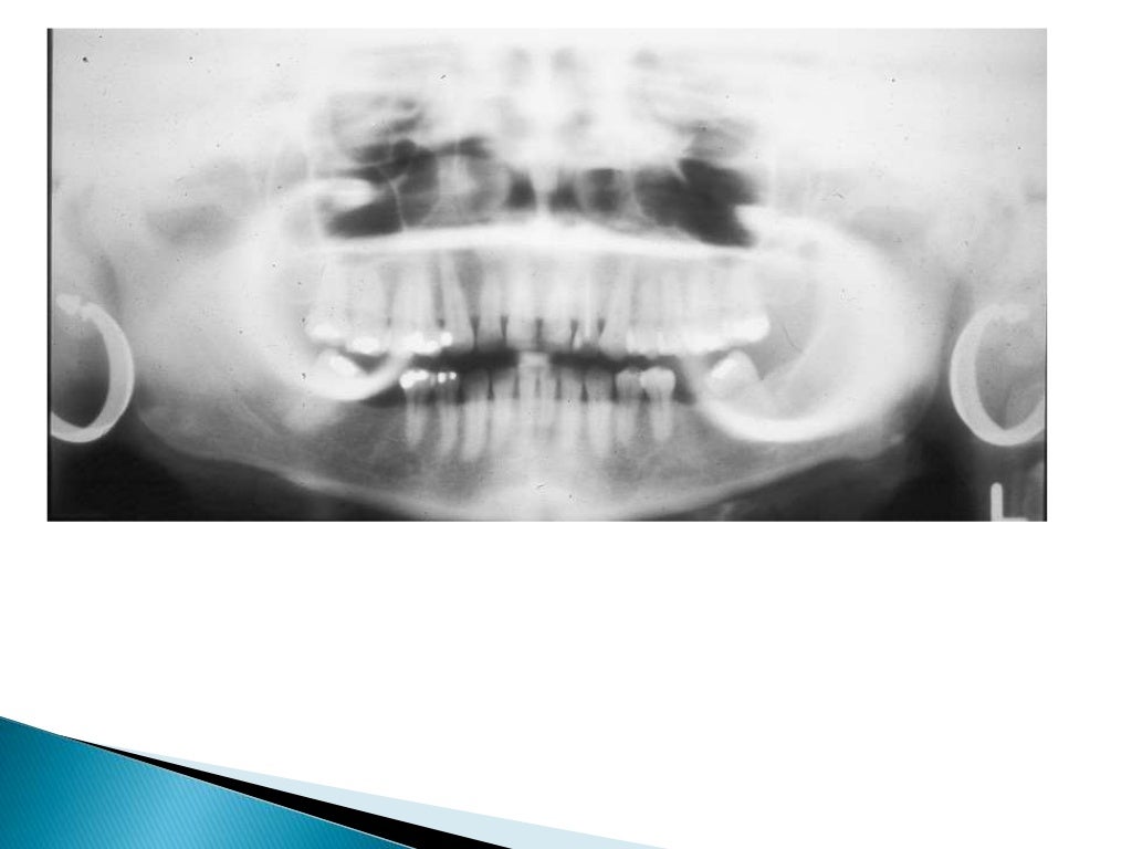 Errors of dental radiography