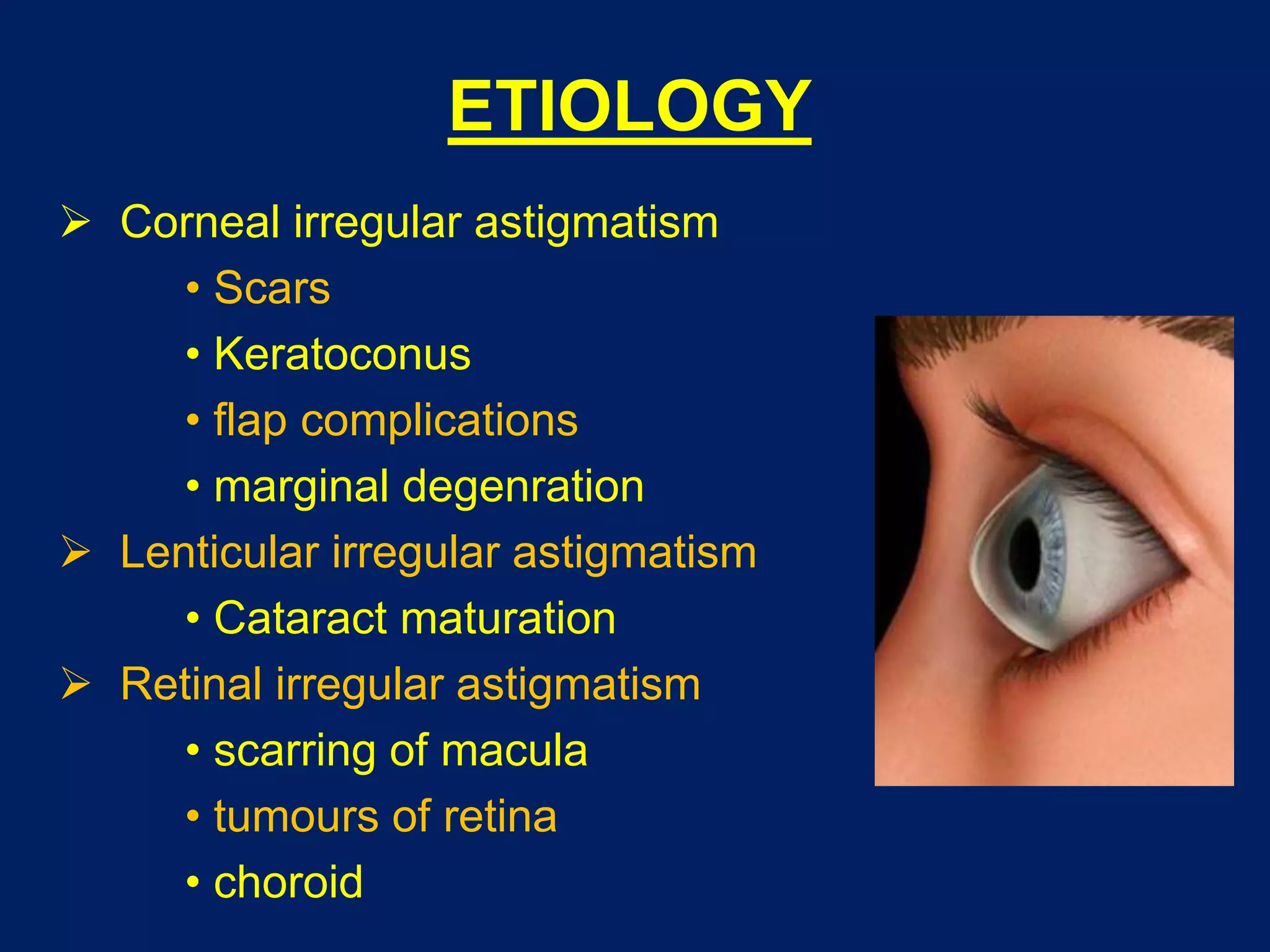 ETIOLOGY
 Corneal irregular astigmatism
• Scars
• Keratoconus
• flap complications
• marginal degenration
 Lenticular irregular astigmatism
• Cataract maturation
 Retinal irregular astigmatism
• scarring of macula
• tumours of retina
• choroid
 
