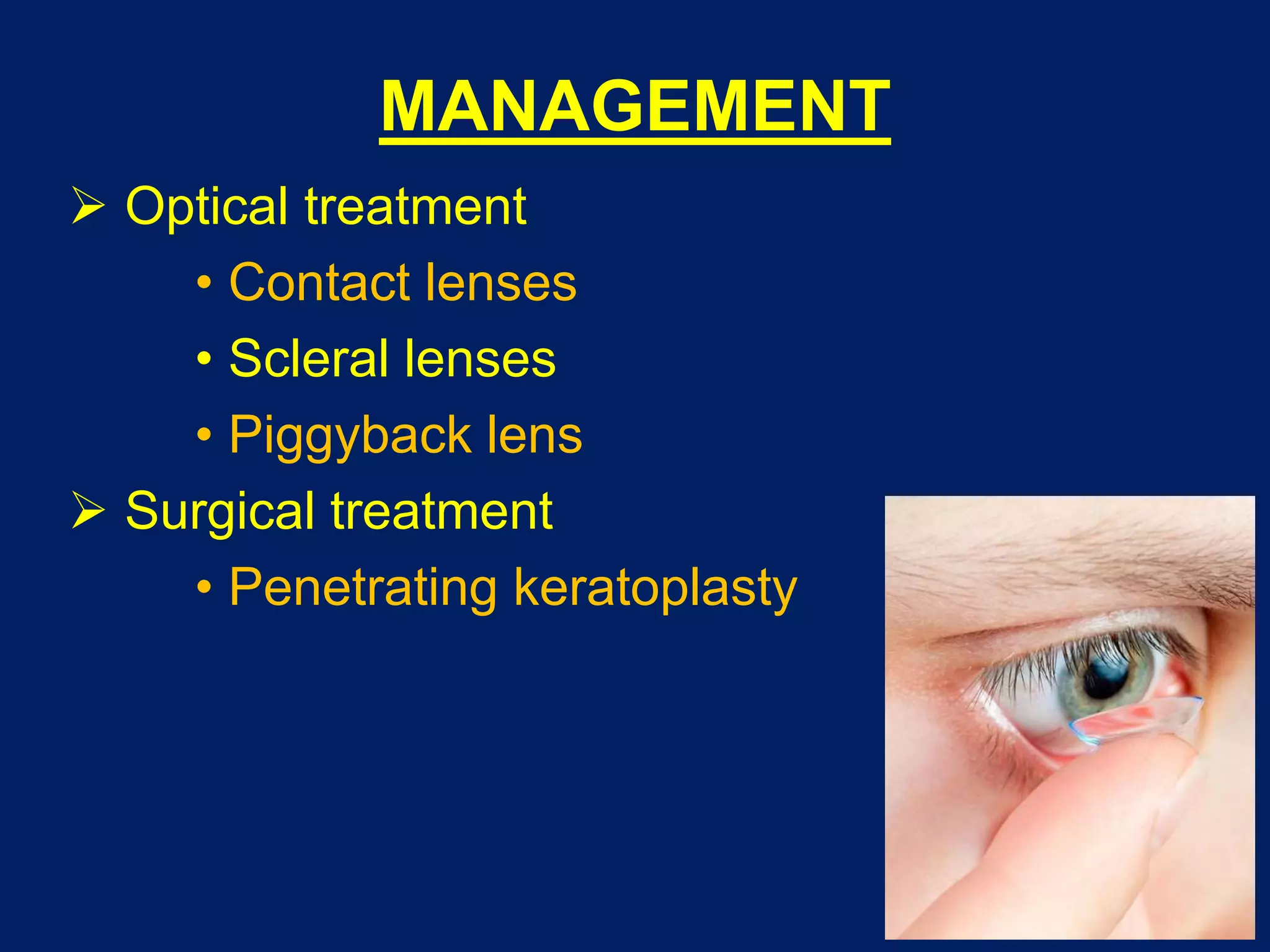 MANAGEMENT
 Optical treatment
• Contact lenses
• Scleral lenses
• Piggyback lens
 Surgical treatment
• Penetrating keratoplasty
 