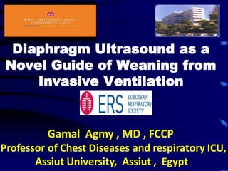 Diaphragm Ultrasound as a
Novel Guide of Weaning from
Invasive Ventilation
Gamal Agmy , MD , FCCP
Professor of Chest Diseases and respiratory ICU,
Assiut University, Assiut , Egypt
 