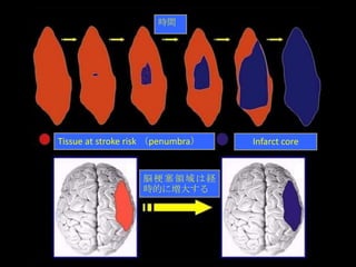 E rstroke.m4lecture | PPTX
