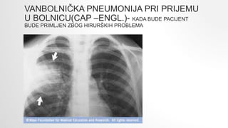 VANBOLNIČKA PNEUMONIJA PRI PRIJEMU
U BOLNICU(CAP –ENGL.)- KADA BUDE PACIJENT
BUDE PRIMLJEN ZBOG HIRURŠKIH PROBLEMA
 