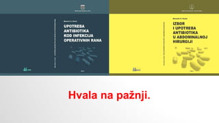 Hvala na pažnji.
 
