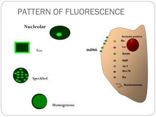 PATTERN OF FLUORESCENCE
Speckled
Homogenous
Rim
Nucleolar
 