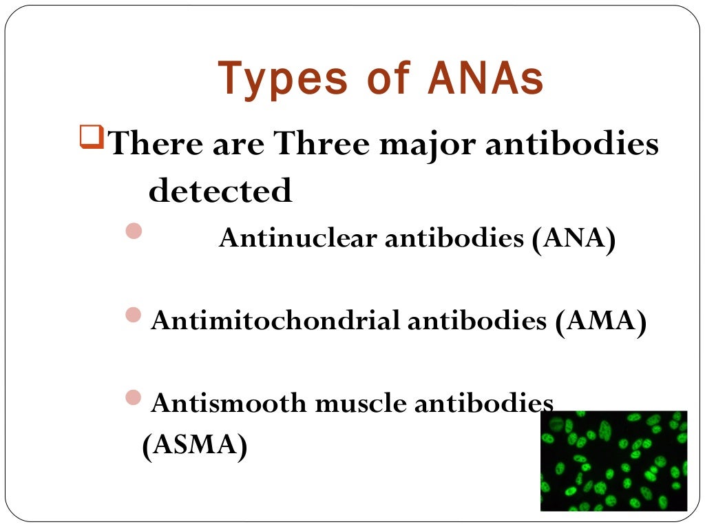 ANTINUCLEAR ANTIBODY
