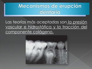 Las teorías más aceptadas son la presión
vascular e hidrostática y la tracción del
componente colágeno.
 