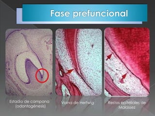 Estadio de campana   Vaina de Hertwig   Restos epiteliales de
   (odontogénesis)                           Malassez
 