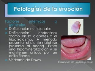 Factores        sistémicos     o
  generales
 Deficiencias nutricionales
 Deficiencias        endocrinas
  :como en la diabetes o el
  hipotiroidismo. A menudo
  presentar el diente natal (se
  presenta al nacer). Existe
  una hipomineralización y se
  mantienen unidos por un
  anillo fibroso
 Síndrome de Down
                                   Extracción de un diente natal
 