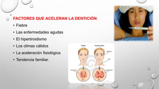 FACTORES QUE ACELERAN LA DENTICIÓN:
• Fiebre
• Las enfermedades agudas
• El hipertiroidismo
• Los climas cálidos
• La aceleración fisiológica
• Tendencia familiar.
 