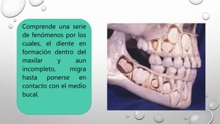 Comprende una serie
de fenómenos por los
cuales, el diente en
formación dentro del
maxilar y aun
incompleto, migra
hasta ponerse en
contacto con el medio
bucal.
 