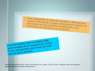 David B. Kennedy B.D.S, M.S.D and Patrick K. Turkey, D.D.S. M.S.D. Manejo clínico de erupción
ectópica primeros molares permanentes.
 