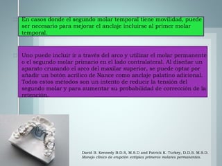 David B. Kennedy B.D.S, M.S.D and Patrick K. Turkey, D.D.S. M.S.D.
Manejo clínico de erupción ectópica primeros molares permanentes.
 
