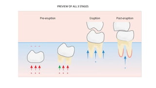 Over Eruption Eruption of tooth and theories of eruption in primary tooth | PPTX