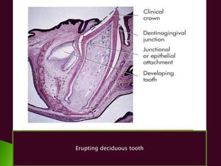 Eruption of teeth ( Hesham Dameer ) | PPTX