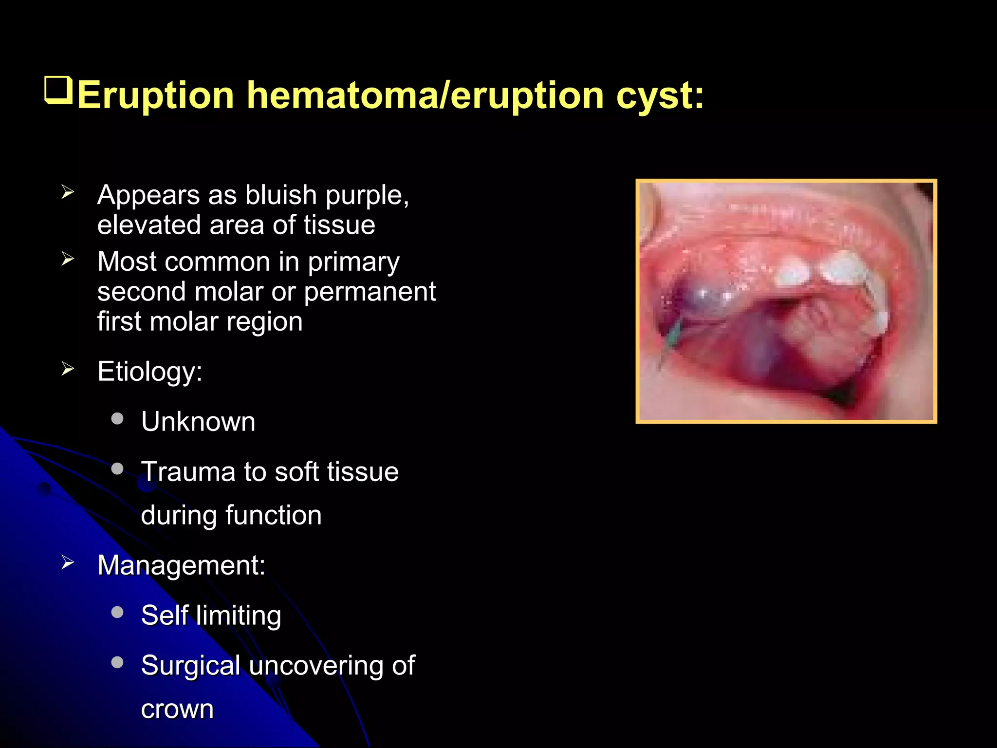 Eruption hematoma/eruption cyst:Eruption hematoma/eruption cyst:
 Appears as bluish purple,Appears as bluish purple,
elevated area of tissueelevated area of tissue
 Most common in primaryMost common in primary
second molar or permanentsecond molar or permanent
first molar regionfirst molar region
 Etiology:Etiology:
 UnknownUnknown
 Trauma to soft tissueTrauma to soft tissue
during functionduring function
 Management:Management:
 Self limitingSelf limiting
 Surgical uncovering ofSurgical uncovering of
crowncrown
 