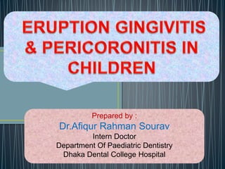 Prepared by : 
Dr.Afiqur Rahman Sourav 
Intern Doctor 
Department Of Paediatric Dentistry 
Dhaka Dental College Hospital 
 