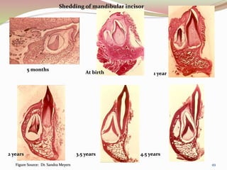 5 months
At birth 1 year
2 years 3.5 years 4.5 years
Shedding of mandibular incisor
Figure Source: Dr. Sandra Meyers 49
 