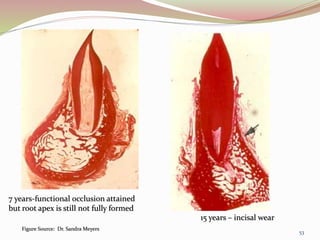 7 years-functional occlusion attained
but root apex is still not fully formed
15 years – incisal wear
Figure Source: Dr. Sandra Meyers
53
 