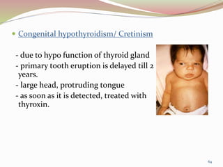  Congenital hypothyroidism/ Cretinism
- due to hypo function of thyroid gland
- primary tooth eruption is delayed till 2
years.
- large head, protruding tongue
- as soon as it is detected, treated with
thyroxin.
64
 