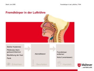 Fremdkörper in der Luftröhre Stand: Juni 2008 Fremdkörper in der Luftröhre  | Folie  Erkennen Beurteilen Handeln Starker Hustenreiz Pfeifendes Atem-geräusch/Atemnot Blaufärbung der Haut Panik Atemstillstand Fremdkörper entfernen Notruf (veranlassen) 