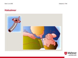 Halsatmer Stand: Juni 2008 Halsatmer  | Folie  