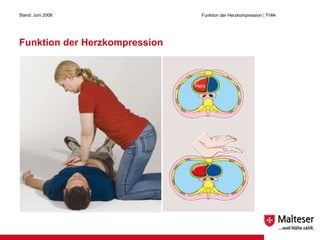 Funktion der Herzkompression Stand: Juni 2008 Funktion der Herzkompression  | Folie  