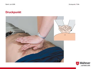 Druckpunkt Stand: Juni 2008 Druckpunkt  | Folie  