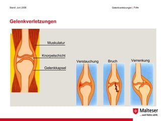 Gelenkverletzungen Stand: Juni 2008 Gelenkverletzungen  | Folie Bruch Muskulatur Verrenkung Verstauchung Knorpelschicht Gelenkkapsel 