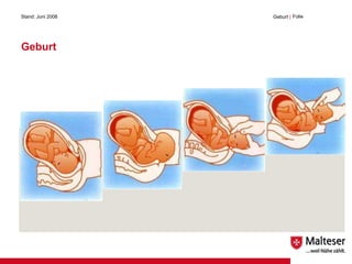 Geburt Stand: Juni 2008 Geburt  | Folie 
