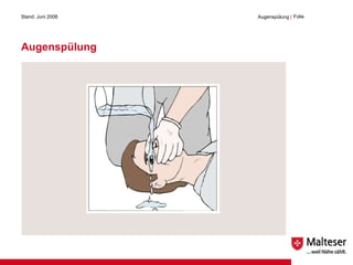Augenspülung Stand: Juni 2008 Augenspülung  | Folie  