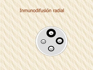 Inmunodifusión radial Ag/4 Ag/2 Ag Ag/8 