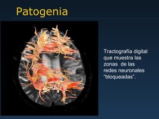 Patogenia Tractografía digital que muestra las zonas  de las redes neuronales  “ bloqueadas ” . 