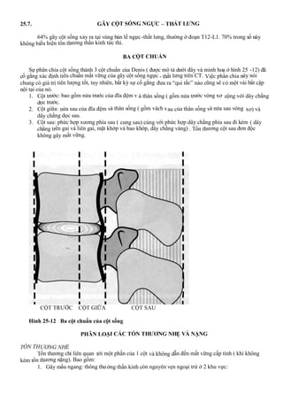 25.7. GÃY CỘT SỐNG NGỰC – THẮT LƯNG
64% gãy cột sống xảy ra tại vùng bản lề ngực-thắt lưng, thường ở đoạn T12-L1. 70% trong số này
không biểu hiện tổn thương thần kinh tức thì.
BA CỘT CHUẨN
Sự phân chia cột sống thành 3 cột chuẩn của Denis ( được mô tả dưới đây và minh hoạ ở hình 25 -12) đã
cố gắng xác định tiêu chuẩn mất vững của gãy cột sống ngực - thắt lưng trên CT. Việc phân chia này nói
chung có giá trị tiên lượng tốt, tuy nhiên, bất kỳ sự cố gắng đưa ra “qui tắc” nào cũng sẽ có một vài bất cập
nội tại của nó.
1. Cột trước: bao gồm nửa trước của đĩa đệm v à thân sống ( gồm nửa trước vòng xơ cộng với dây chằng
dọc trước.
2. Cột giữa: nửa sau của đĩa đệm và thân sống ( gồm vách s au của thân sống và nửa sau vòng xơ) và
dây chằng dọc sau.
3. Cột sau: phức hợp xương phía sau ( cung sau) cùng với phức hợp dây chằng phía sau đi kèm ( dây
chằng trên gai và liên gai, mặt khớp và bao khớp, dây chằng vàng) . Tổn thương cột sau đơn độc
không gây mất vững.
CỘT TRƯỚC CỘT GIỮA CỘT SAU
Hình 25-12 Ba cột chuẩn của cột sống
PHÂN LOẠI CÁC TỔN THƯƠNG NHẸ VÀ NẶNG
TỔN THƯƠNG NHẸ
Tổn thương chỉ liên quan tới một phần của 1 cột và không dẫn đến mất vững cấp tính ( khi không
kèm tổn thương nặng). Bao gồm:
1. Gãy mấu ngang: thông thường thần kinh còn nguyên vẹn ngoại trừ ở 2 khu vực:
 