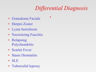 Differential Diagnosis
• Granuloma Faciale
• Herpes Zoster
• Lyme borreliosis
• Necrotizing Fasciitis
• Relapsing
Polychondritis
• Scarlet Fever
• Stasis Dermatitis
• SLE
• Tuberculid leprosy
•
 