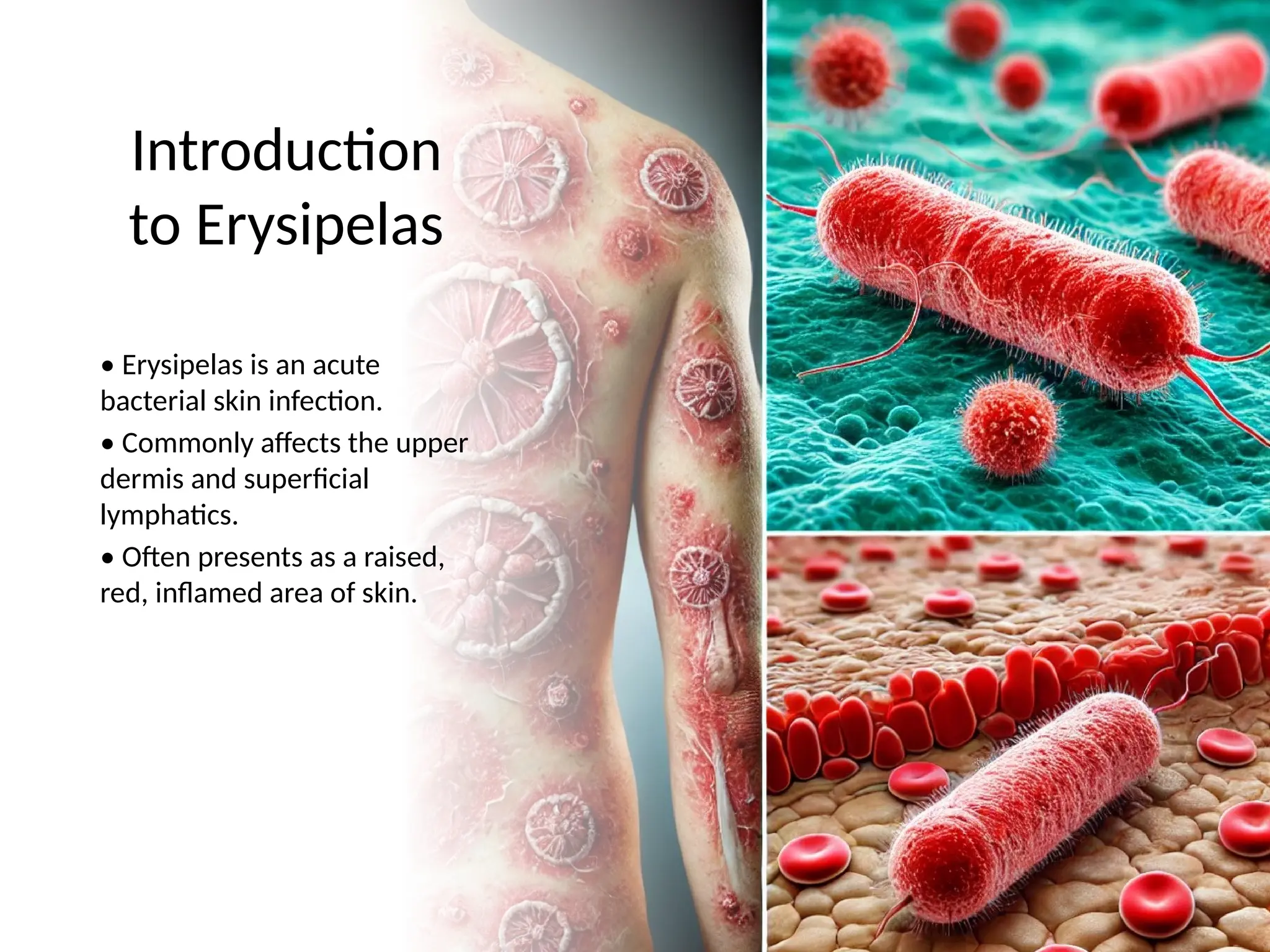 erysipelas-etiology-and-epidemiology-presentation-pptx