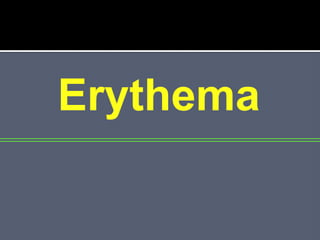 Erythema 