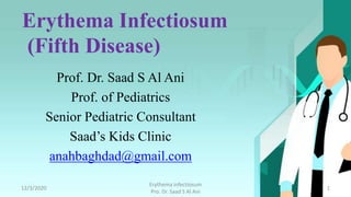 Erythema Infectiosum
(Fifth Disease)
Prof. Dr. Saad S Al Ani
Prof. of Pediatrics
Senior Pediatric Consultant
Saad’s Kids Clinic
anahbaghdad@gmail.com
12/3/2020
Erythema infectiosum
Pro. Dr. Saad S Al Ani
1
 