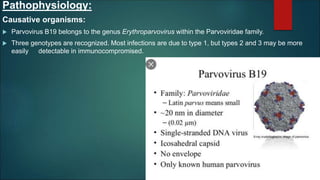 Pathophysiology:
Causative organisms:
 Parvovirus B19 belongs to the genus Erythroparvovirus within the Parvoviridae family.
 Three genotypes are recognized. Most infections are due to type 1, but types 2 and 3 may be more
easily detectable in immunocompromised.
 