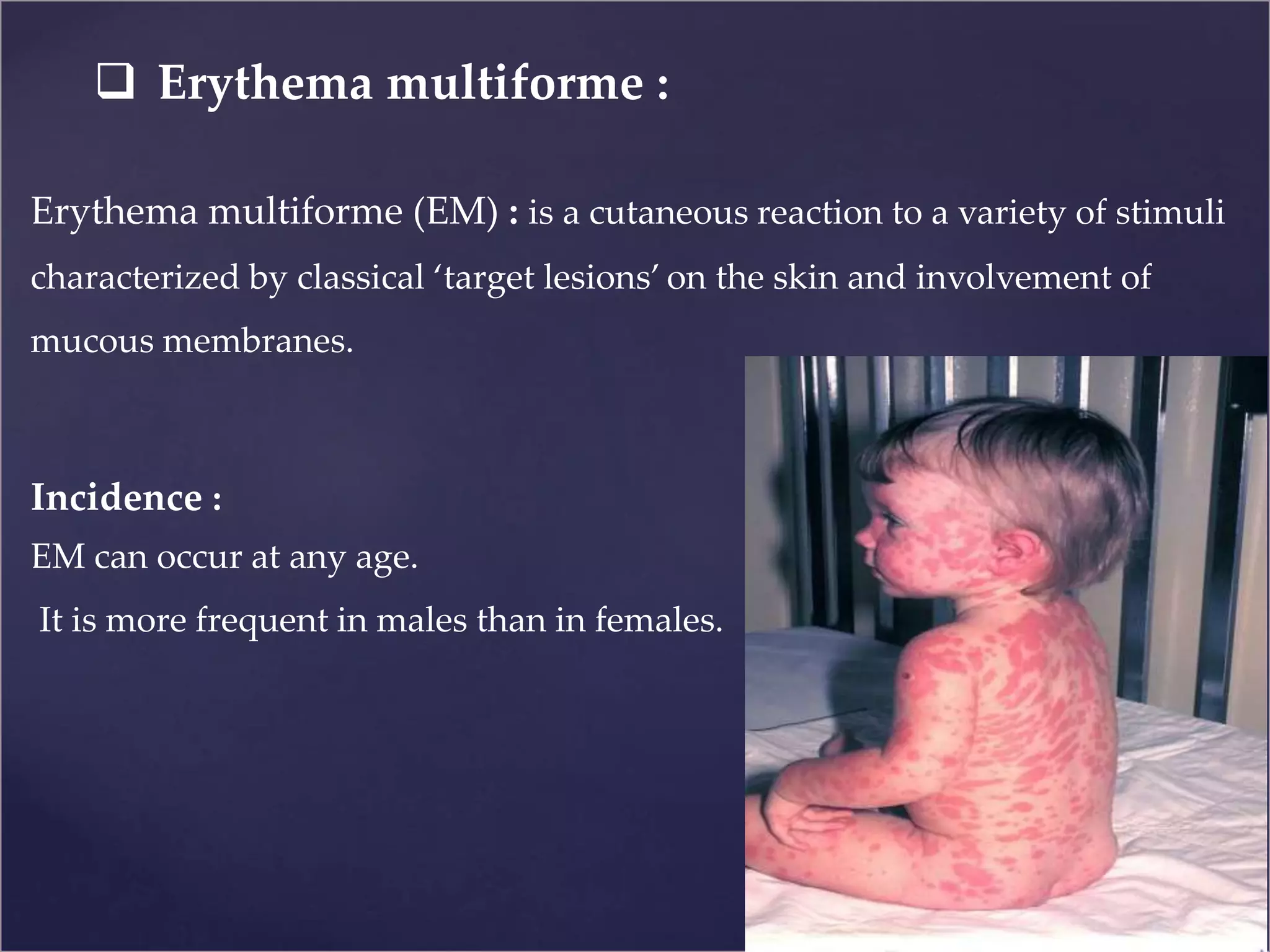 Erythema Multiforme Minor Causes