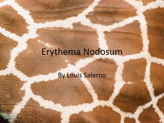 Erythema Nodosum
By Louis Salerno
 