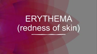 ERYTHEMA
(redness of skin)
 