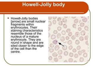 Howell Body Erythocyte | PPT
